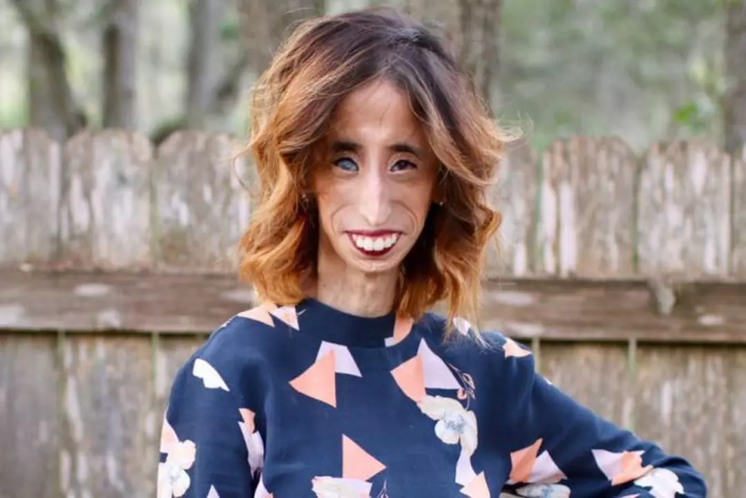 A Fost Supranumita Cea Mai UratÄƒ Femeie Din Lume Cum AratÄƒ Lizzie Velasquez Acum E Total SchimbatÄƒ