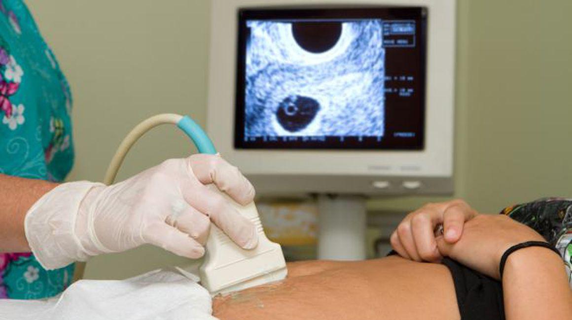 Durerea De Ovare Ce Inseamnă Si Care Sunt Cauzele Boli Si