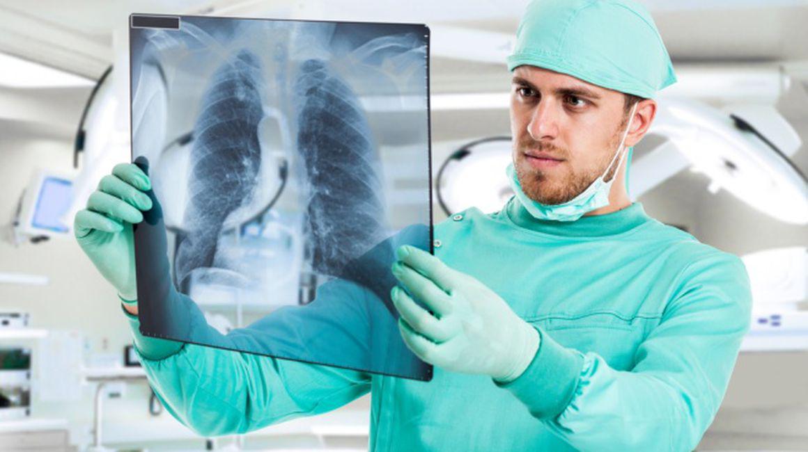 Pneumonie Sau Cancer La Plămani Cum Faci Diferenţa Boli Si Tratamente Sănătate Unica Ro