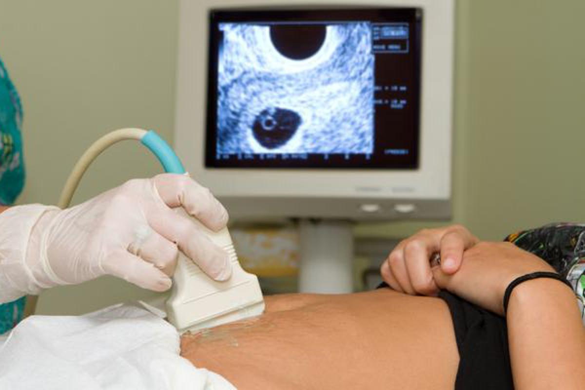 Cat Dureaza O Operatie De Chist Ovarian Chist Ovarian Tratament Cu Antibiotice - asdfd