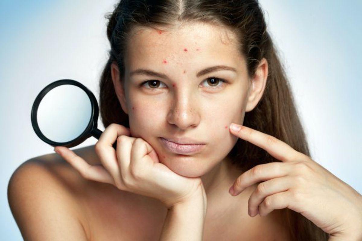 Cum Să Scapi De Cosuri Intr O Săptămană Cosmetică Frumuseţe Homepage Slider Unica Ro