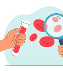 Prevenția ca stil de viață: ce rol au analizele de sânge și la ce perioade se recomandă?