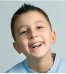 5 sfaturi pentru a-ți ajuta copilul să poarte aparat dentar