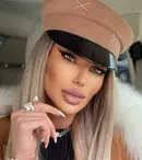 Bianca Drăgușanu și-a micșorat buzele. Cum arată acum