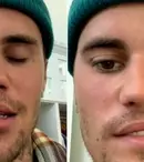 Justin Bieber suferă de paralizie facială cauzată de sindromul Ramsay Hunt. Artistul și-a anulat concertele