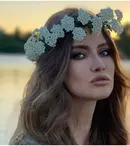 Iulia Albu a ajuns pe mâinile medicului estetician. Cum arată după ce și-a făcut un lifting profund