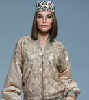 Alina Pușcaș, plină de vânătăi la ochi. Vedeta a recunoscut totul: „Mi-e un pic groază, pentru că doare”. Motivul pentru care a apărut așa în fața fanilor