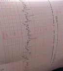 (P) Ecografia Doppler - Ce este și ce afecțiuni neurologice poate depista