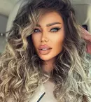 Bianca Drăgușanu, o nouă intervenție estetică. Ce schimbare și-a mai făcut la nivelul feței și cât a costat