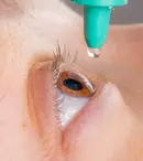 6 lucruri pe care trebuie să le știi despre tratarea glaucomului