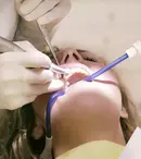 Top 5 greșeli pe care le facem iarna și care ne distrug zâmbetul fără să ne dăm seama