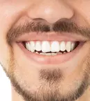 Arhitectura zâmbetului perfect: cum zirconiul redefinește rezistența în estetica dentară