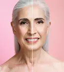 Rejuvenarea facială după 30, 40 și 50 de ani ce tratamente pot fi potrivite în funcție de vârstă și tipul de ten