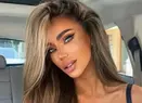 Bianca Drăgușanu a ajuns pe mâna medicilor, cu fața umflată, din cauza unei alergii: "I s-au administrat perfuzii"
