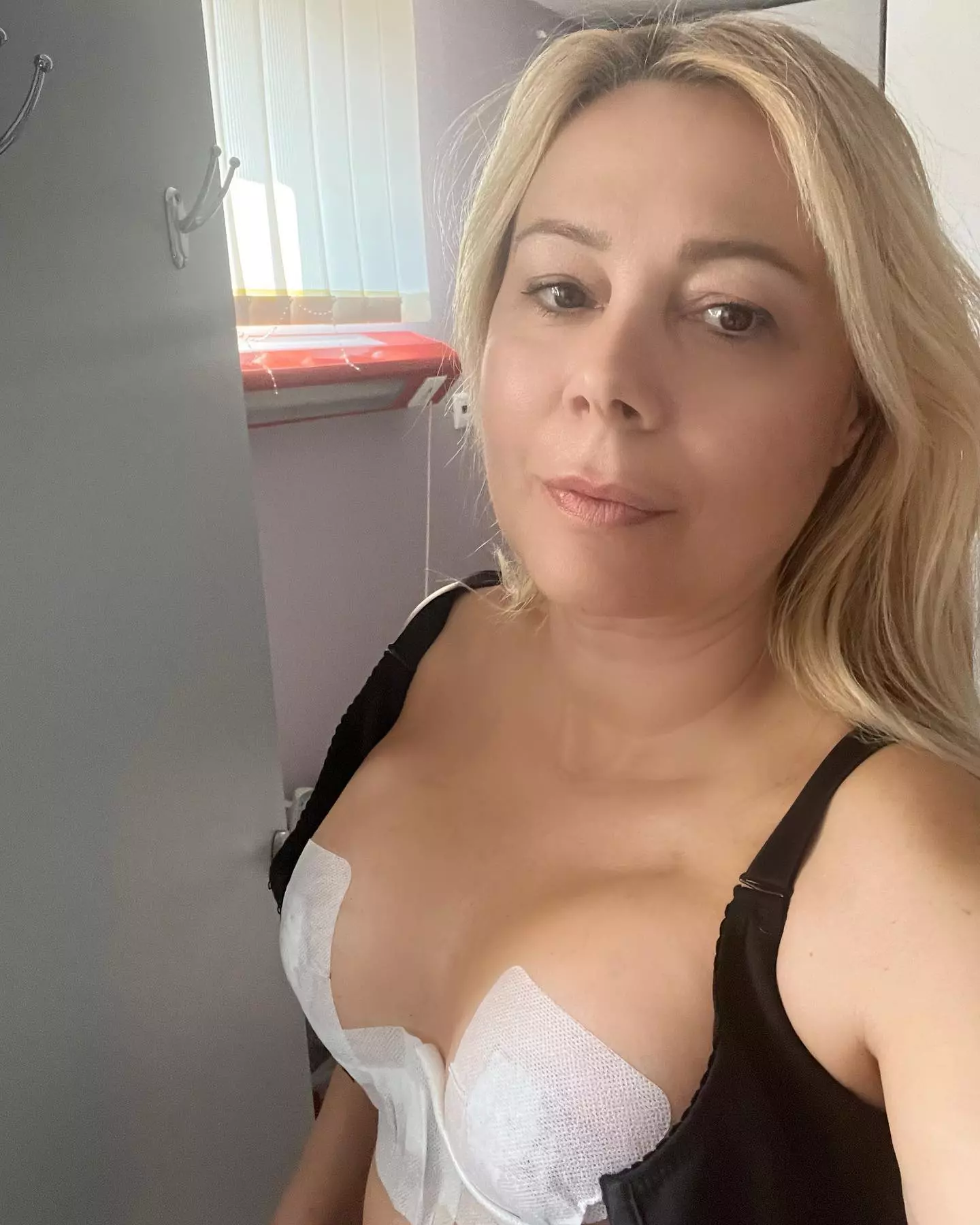 Dana Săvuică și-a micșorat sânii