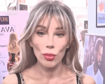 Cum arată vedeta noastră, după ce și-a făcut lifting facial: „Am purtat ochelari de soare în casă să nu sperii copiii”