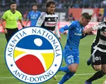 Fără precedent! Suma colosală pe care o plătesc oltenii pentru testul antidoping comandat la finala SuperLigii cu U Cluj