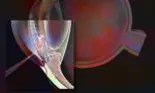 Glaucom – Tipuri de glaucom. Cauze. Factori de risc. Tratament. Ce spune dr. Monica Pop