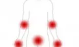 Psoriazis – boala genetica de piele