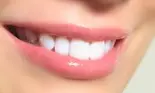 Velvet Dental iti desensibilizeaza dintii