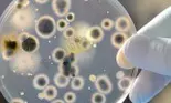 Cum scapam de bacterii fara iritatii, alergii sau intoxicatii?