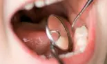 La dentist, fara durere