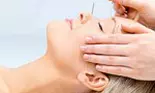 Acupunctura cosmetica mi-a intinerit fata cu 7-8 ani