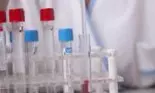 Depistează acum cancerul de col uterin