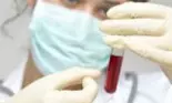 Plan pentru bolnavii de Hepatita C