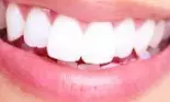 Dr. Octavian Făgăraş îţi răspunde la întrebări! Astăzi vorbim despre albirea dentară!