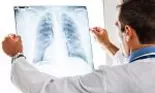 De câte tipuri este pneumonia și ce simptome ar trebui să îți dea de bănuit