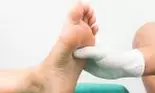 Ai tălpile fierbinți? Poate fi semn de diabet
