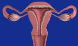 Principalele simptome care indică prezența cancerului ovarian