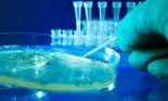 Vânătăile pot fi indica infectarea cu hepatita C