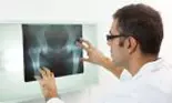 Fractura de șold poate duce la complicații grave