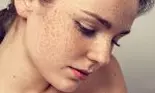 Scapă de pistrui cu apă de tărâţe cu zeamă de lămâie