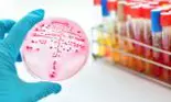 Testul care ajută la prevenirea cancerului, disponibil și în România