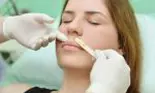 Cum să scapi definitiv de mustață în 5 minute, doar cu 3 ingrediente naturale