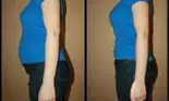 Cum se prepară cel mai bun remediu natural împotriva balonării? Îmbunătățește digestia și te ajută să slăbești