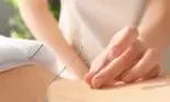Bolile pe care le poți trata cu ajutorul acupuncturii. Celebra metodă chinezească care te scapă rapid de dureri