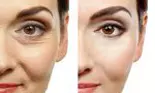 Cum să-ți faci acasă un ser natural pentru ochi? Ridurile vor fi șterse de pe pielea ta în doar două săptămâni