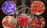Moartea începe în colon, așa spune un laureat al Premiului Nobel pentru Medicină. Iată de ce