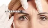 De la ce vârstă putem apela la injecțiile cu botox