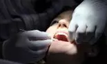 (P) Implanturi dentare în Clinica Stomatologică Dental Excellence