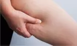 Obiceiurile care duc la apariția celulitei. Evită să faci aceste lucruri dacă vrei să scapi de aspectul de coajă de portocală