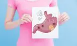 Cum să previi cancerul de stomac. 17 reguli de la un celebru neurochirurg