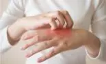 Cum poți trata rapid eczemele? 4 lucruri de care trebuie să ții cont