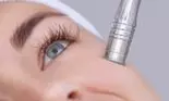 Tratamentul care te scapă de cicatricile inestetice