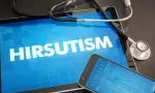 Hirsutismul sau hipertricoza. Ce este și ce soluții există pentru această afecțiune