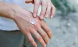 Aproximativ 5% dintre români suferă de psoriazis. Boala NU este transmisibilă